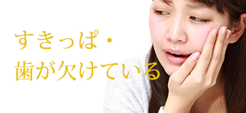 すきっぱ・歯が欠けている