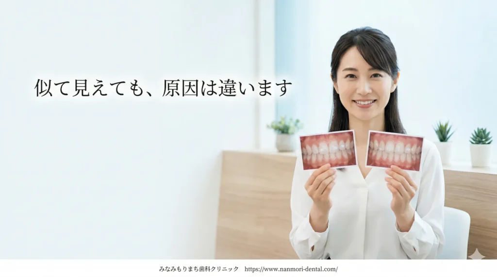 エナメル質形成不全と虫歯(初期むし歯)はなぜ見た目が似ているのか