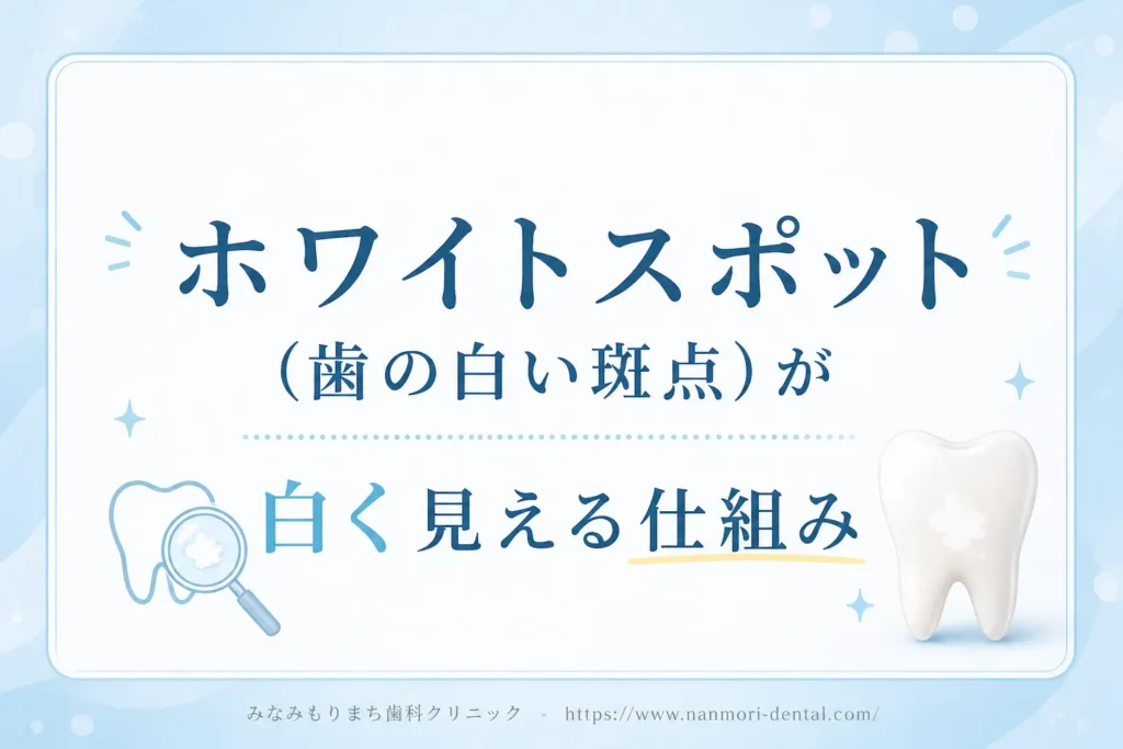 ホワイトスポット（歯の白い斑点）が白く見える仕組み