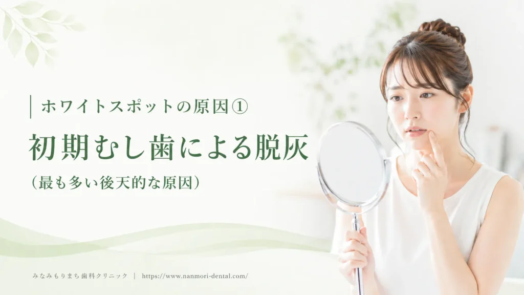 ホワイトスポットの原因①初期むし歯による脱灰（最も多い後天的な原因）