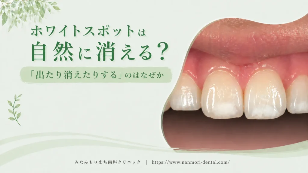 ホワイトスポットは自然に消える？「出たり消えたりする」のはなぜか