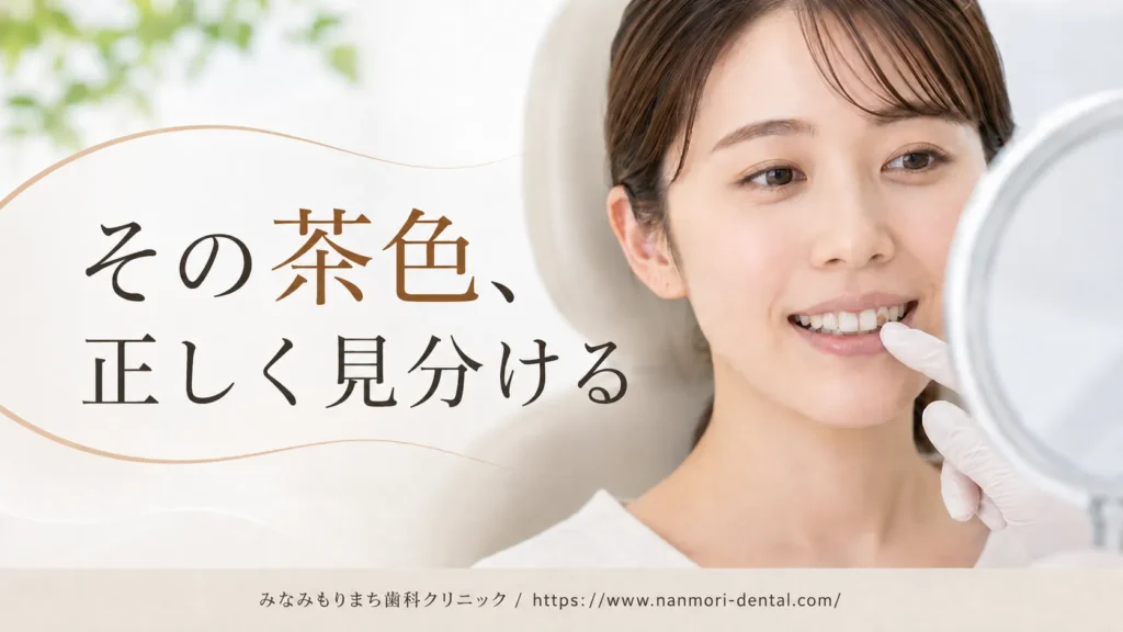 その茶色は着色汚れ？むし歯？ブラウンスポットとの見分け方