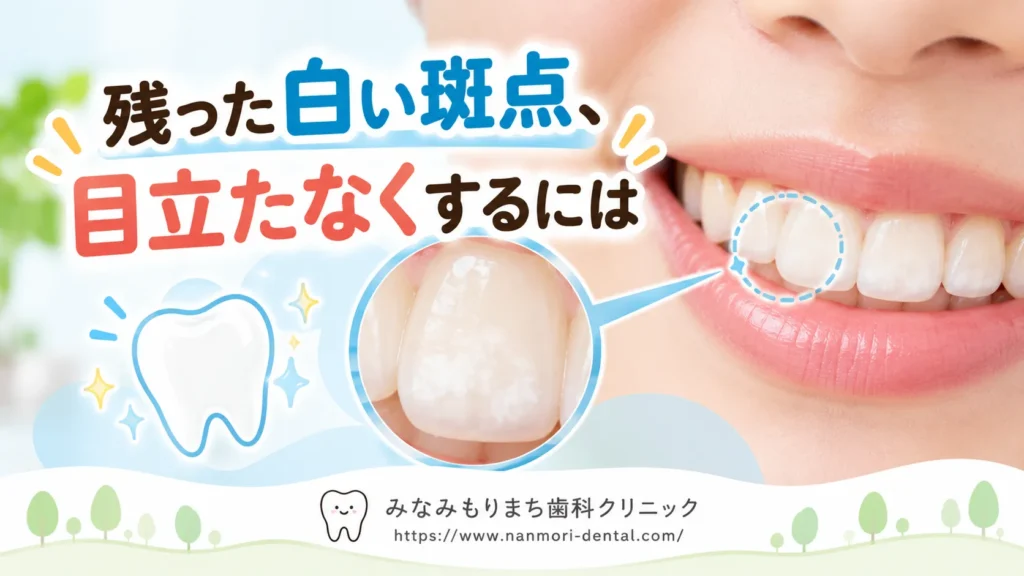 歯の脱灰で残った白い斑点が気になるとき