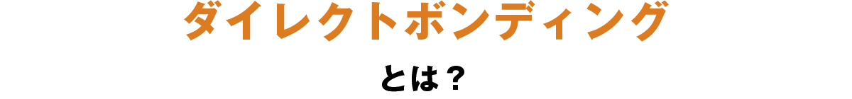 ダイレクトボンディングとは？