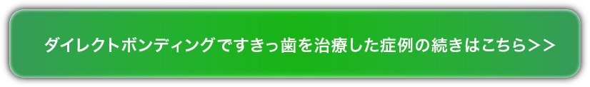  ダイレクトボンディングですきっ歯を治療した症例の続きはこちら＞＞