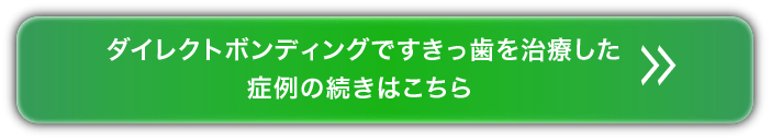  ダイレクトボンディングですきっ歯を治療した症例の続きはこちら＞＞