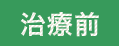治療前