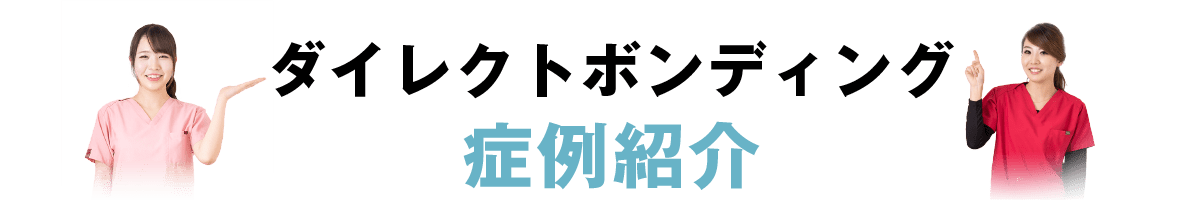 ダイレクトボンディング症例紹介